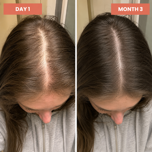 Beauty Dose Peptide Hair Serum