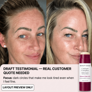 Beauty Dose under-eye draft gallery image 5