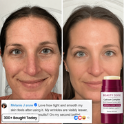 Beauty Dose Calcium Balm product gallery 8