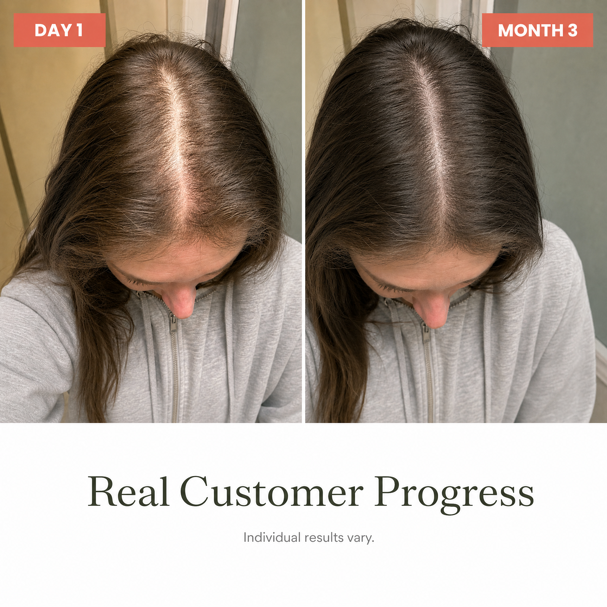 Beauty Dose real customer Day 1 and Month 3 progress